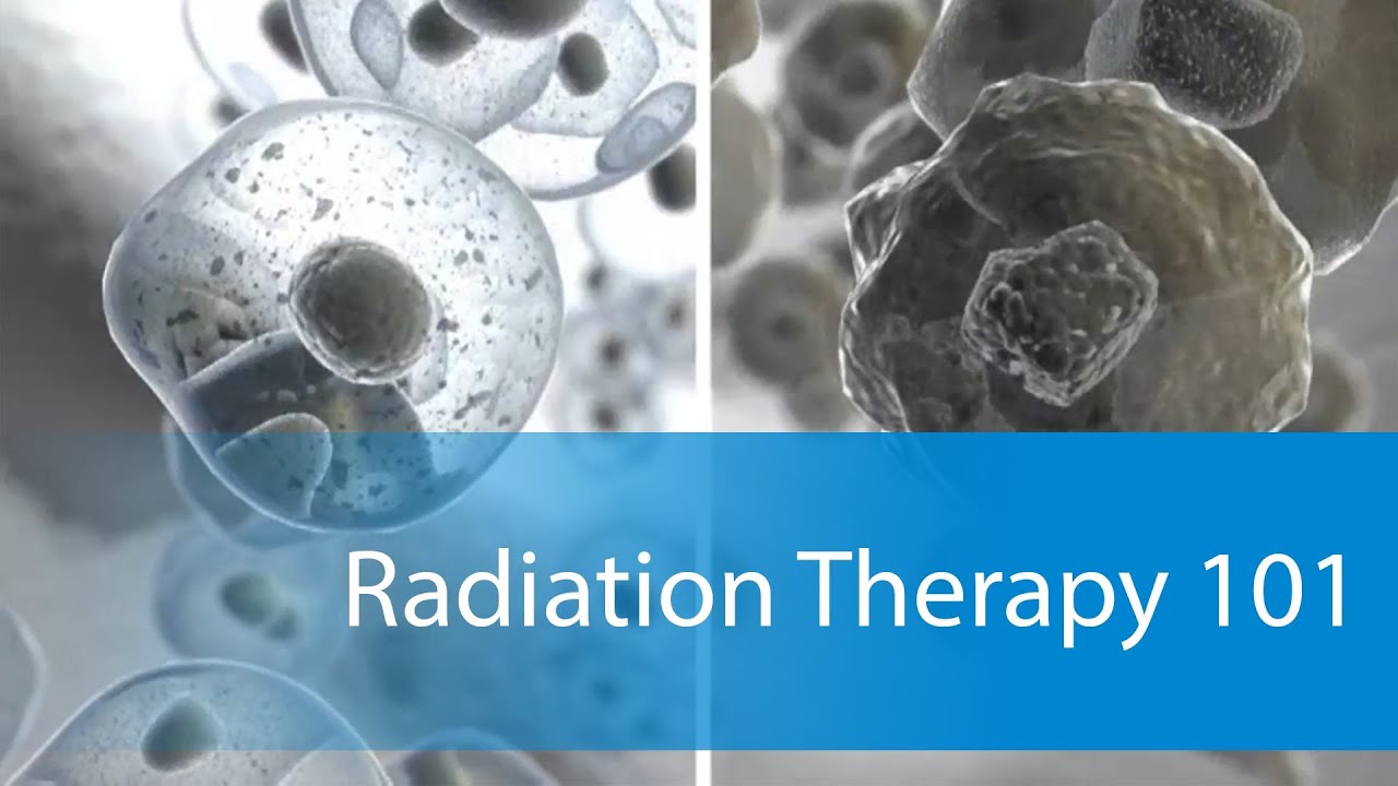 How does Radiotherapy work? How does Radiotherapy work?