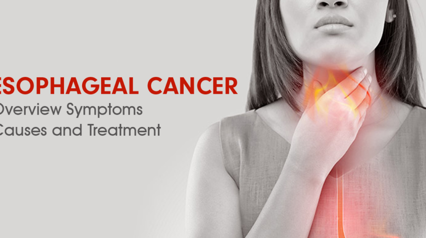 Oesophageal Cancer (Carcinoma): Overview, Symptoms, Causes and Treatment