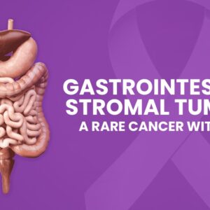 Gastrointestinal Stromal Tumors (GISTs): Understanding a Rare but Treatable Cancer Gastrointestinal Stromal Tumors (GISTs): Understanding a Rare but Treatable Cancer
