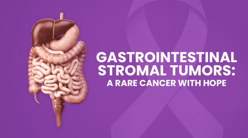 Gastrointestinal Stromal Tumors (GISTs): Understanding a Rare but Treatable Cancer Gastrointestinal Stromal Tumors (GISTs): Understanding a Rare but Treatable Cancer