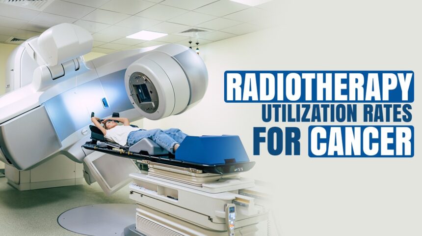 Radiotherapy Utilization Rates for Cancer: A Global Perspective Radiotherapy Utilization Rates for Cancer: A Global Perspective